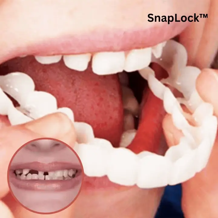 🔥 SnapSmile™ Adjustable Dentures — HIDING YOUR SMILE? STOP.