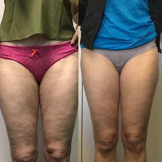 🔥 TRIPLE PEPTIDE FIRMING CREAM — WHY ARE YOU STILL WALKING AROUND WITH SAGGY, WRINKLED SKIN?