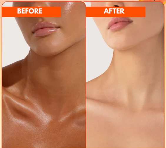 ✨ ScarAway™ Whitening Soap – Erase Dark Spots & Reveal Radiant Skin Instantly! - Image 2