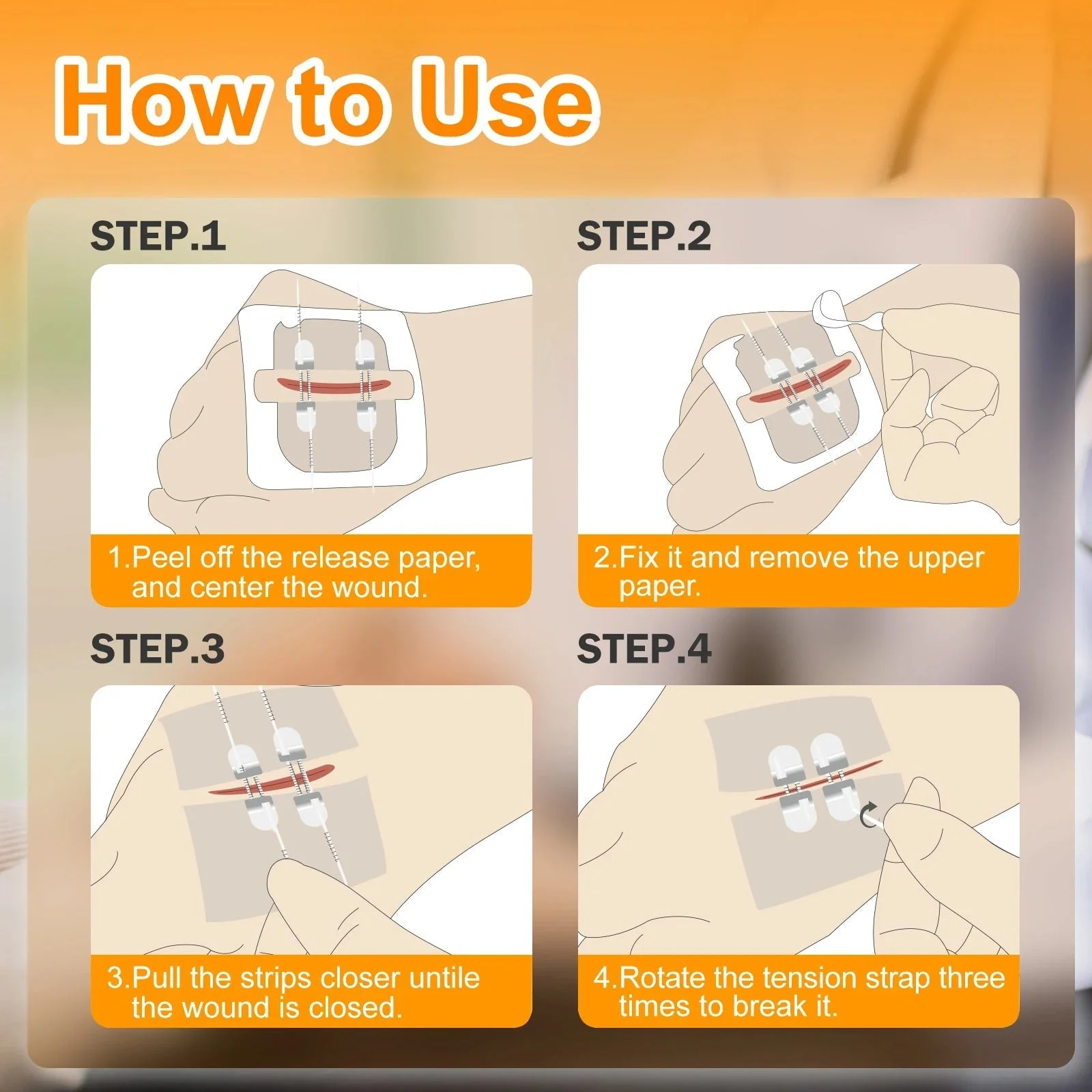 2PCS Advanced Wound Closure Kit - Image 6