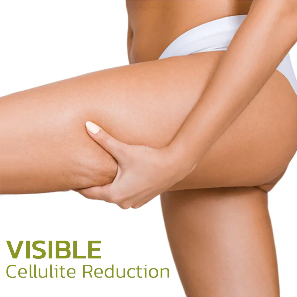 CelluSmooth™ Huidverbeterende en Cellulite Verminderende Oplossing - Image 2