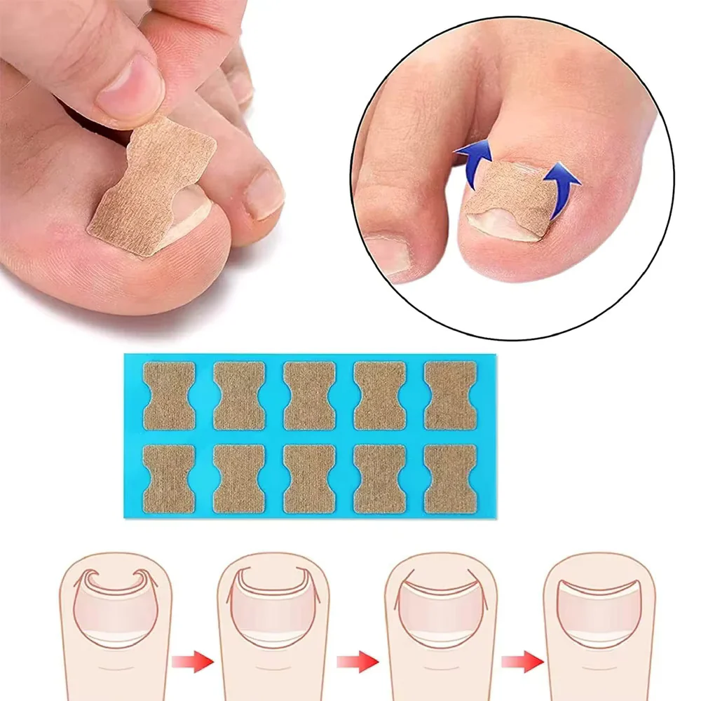 Ingrown Toenail Tools Set - Image 3