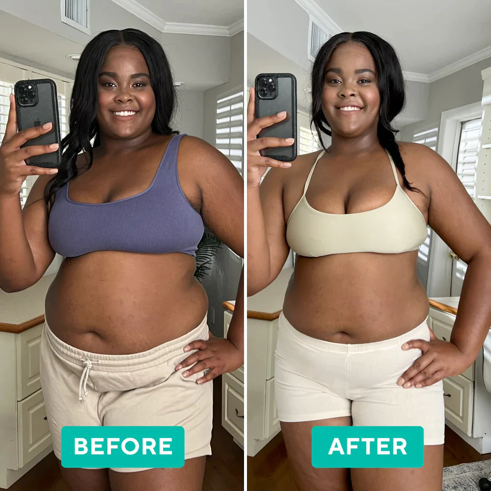 Sohobloo CelAway™ | Say goodbye to fat and cellulite! - Image 4