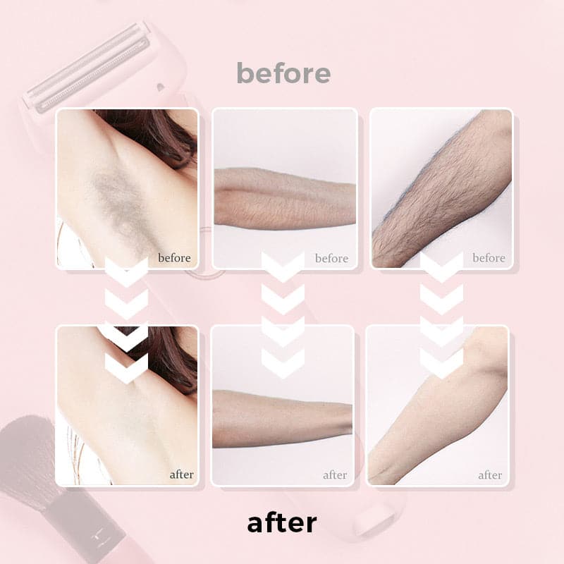 Effortless 2-in-1 Body Hair Razor for Smooth Skin (+Free Gift Included) - Image 10