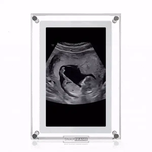 🎥SnapFrame™ Digital Picture Frame – Capture & Relive Precious Moments Instantly! 💖 - Image 3