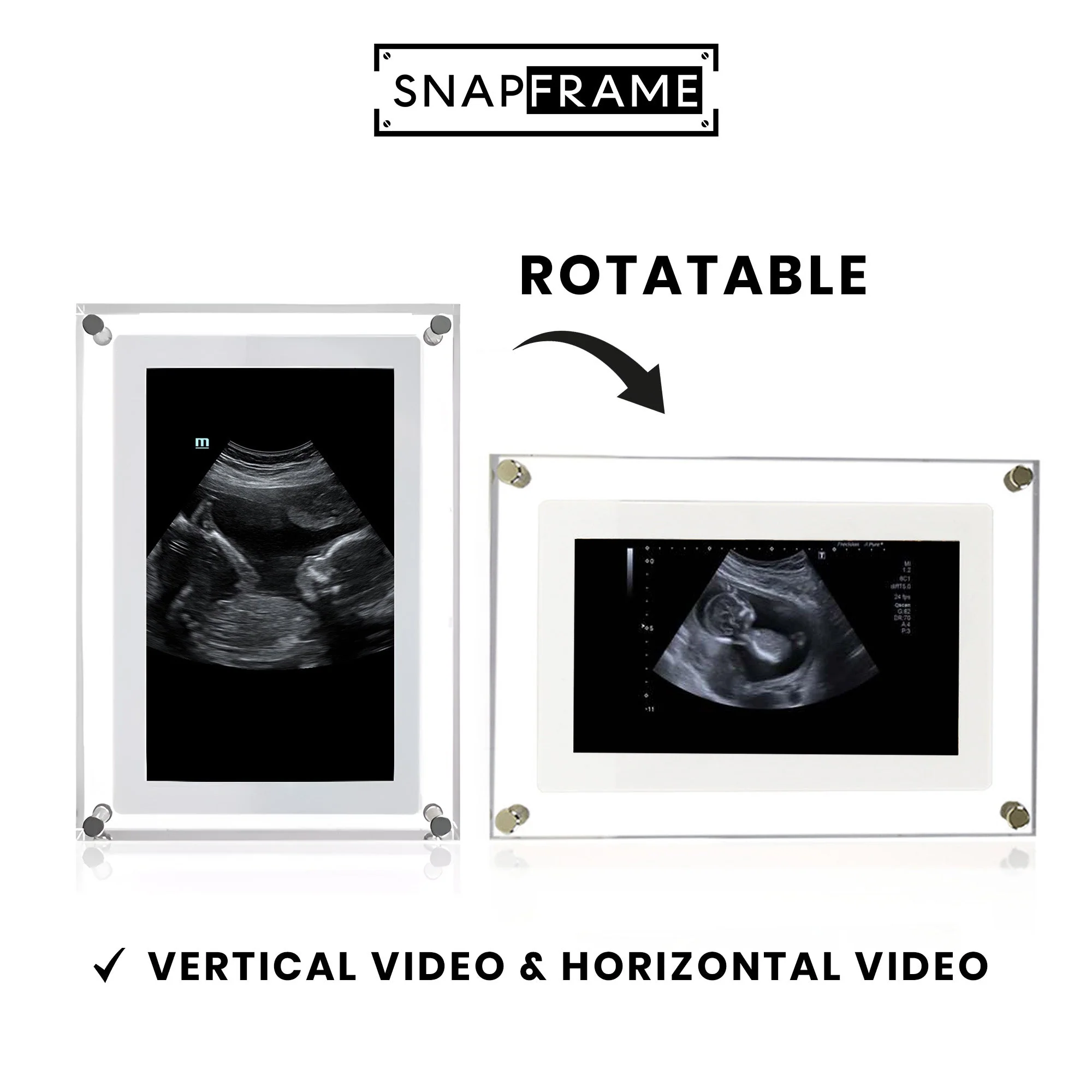 🎥SnapFrame™ Digital Picture Frame – Capture & Relive Precious Moments Instantly! 💖 - Image 5
