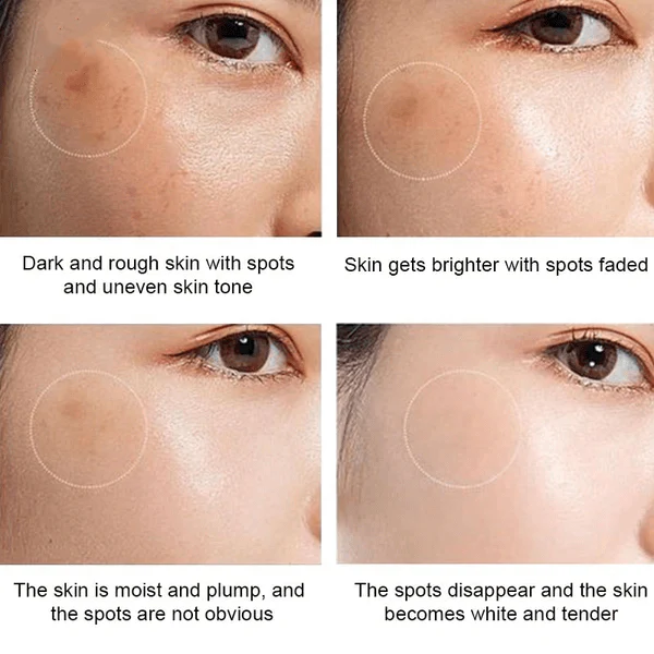 Whitening Freckle Cream Face Moisturizing Face Skin Care - Image 4